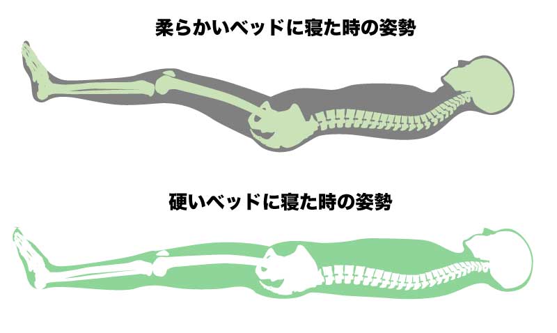 柔らかい敷布団マットレスを使うと、仰向け寝ができないほど、背骨がまっすぐになりすぎる寝姿勢になる