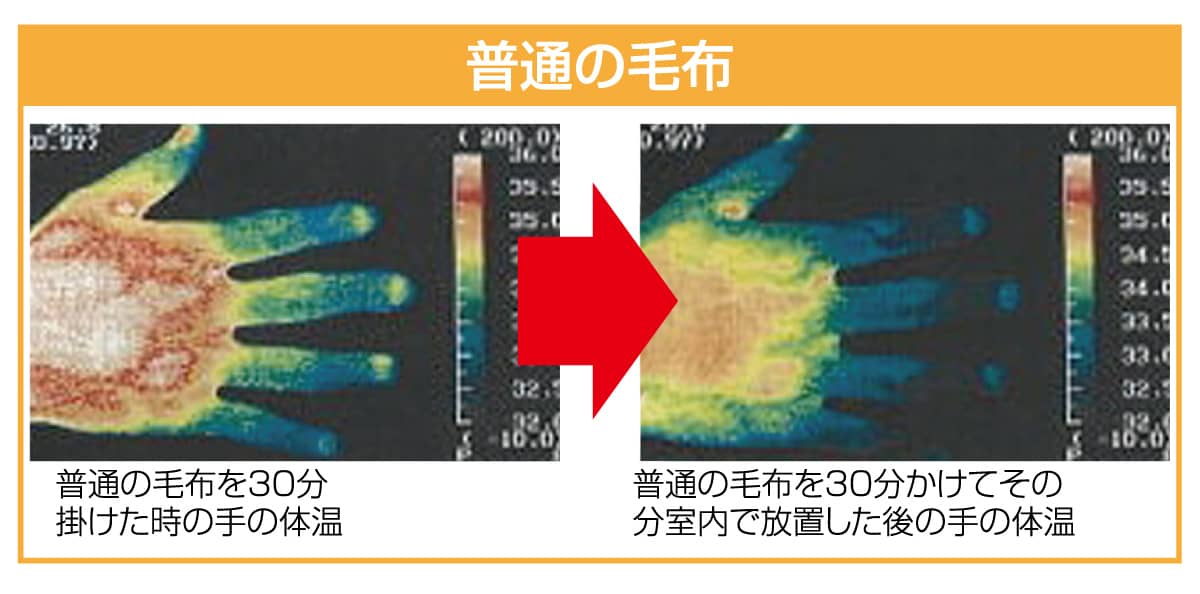 普通の毛布をかけた状態の手のひら